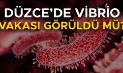 DÜZCE İL SAĞLIK MÜDÜRLÜĞÜ AÇIKLAMA YAPTI