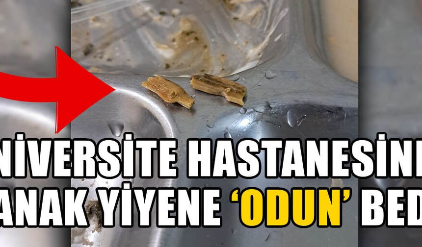 REFAKATÇİNİN YEMEĞİNDEN ÇIKANLAR MİDE BULANDIRDI