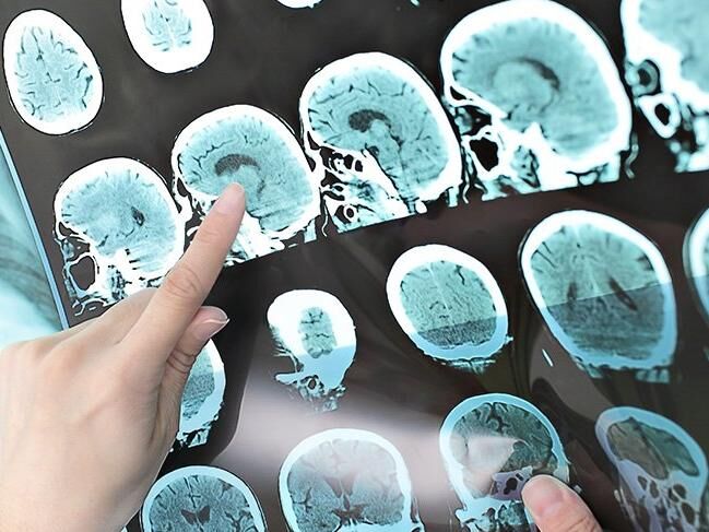 Ms Shutter 4 3 1590759280